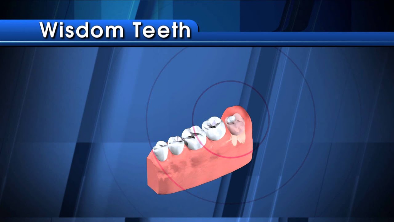 youtube placeholder image